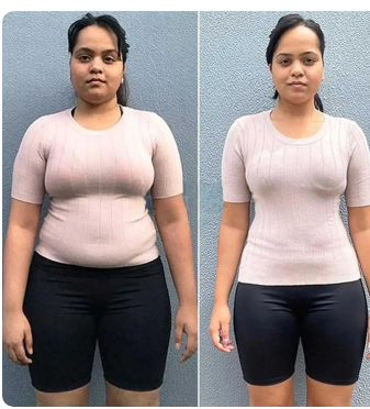 Antes e depois de Thays Almeida