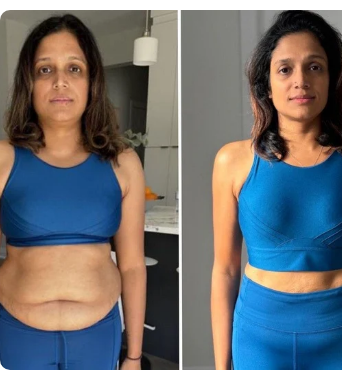Antes e depois de Sonia Lima